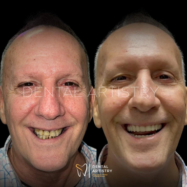 Slider image (9) Dental Artistry Dental Center